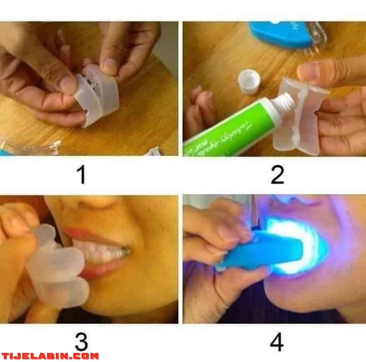 جهاز تبييض الاسنان الطبي بالليزر